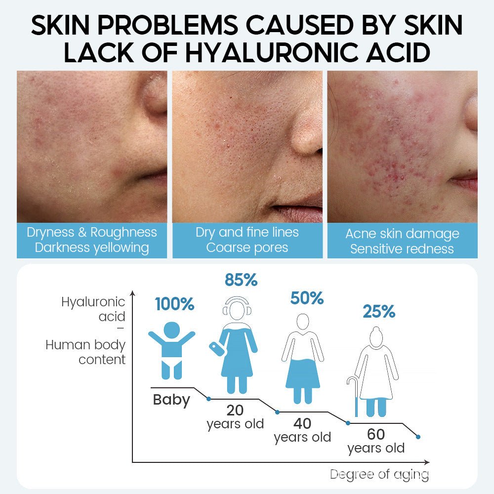 Hyaluronic Acid Face Serum Anti-Aging Shrink Pore Whitening Moisturizing Face Cream Dry Skin Care - pokema451b5e9520c971b044654ac51384f219