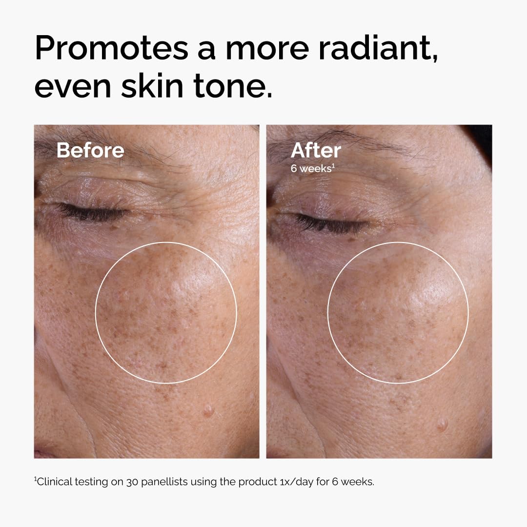 The Ordinary Acide glycolique 7 % tonifiant exfoliant, éclaircissant et lissant pour un teint plus uniforme - pokemaThe Ordinary Acide glycolique 7 % tonifiant exfoliant, éclaircissant et lissant pour un teint plus uniforme